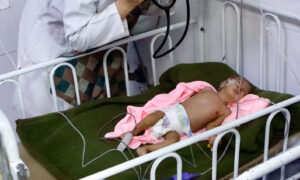 سازمان ملل: افغانستان با بدترین موج سوءتغذیه در تاریخ خود روبه‌رو است